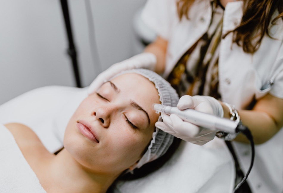 Microneedling Behandlung & Erfahrungen